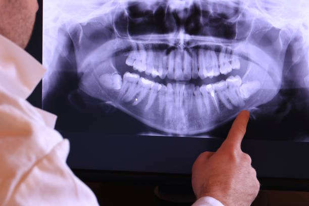 Best Urgent Tooth Repair  in Columbiana, OH