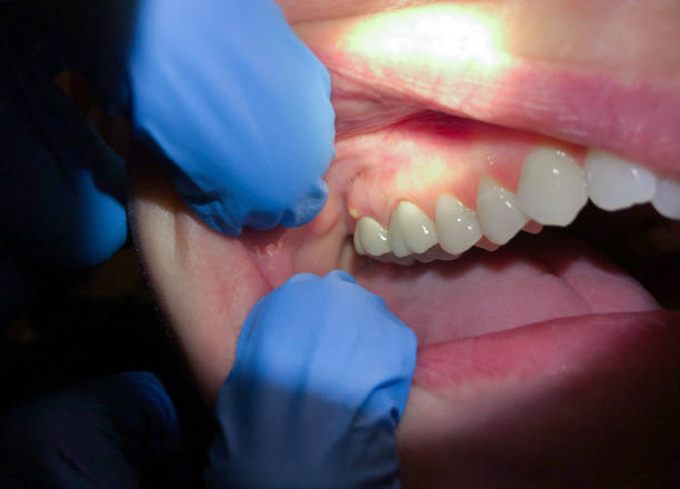 Best Emergency Dental Services Near Me  in Columbiana, OH